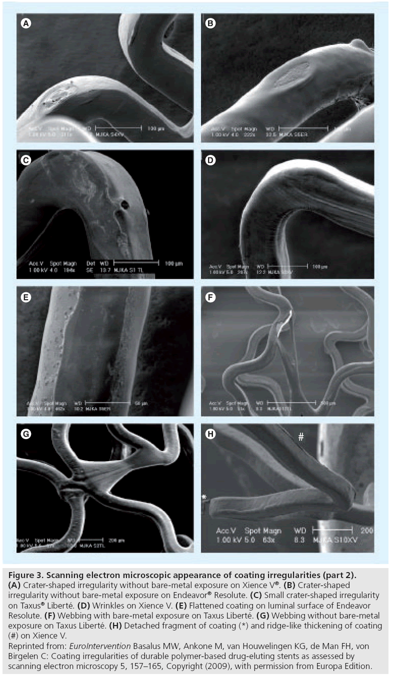 interventional-cardiology-coating-irregularities