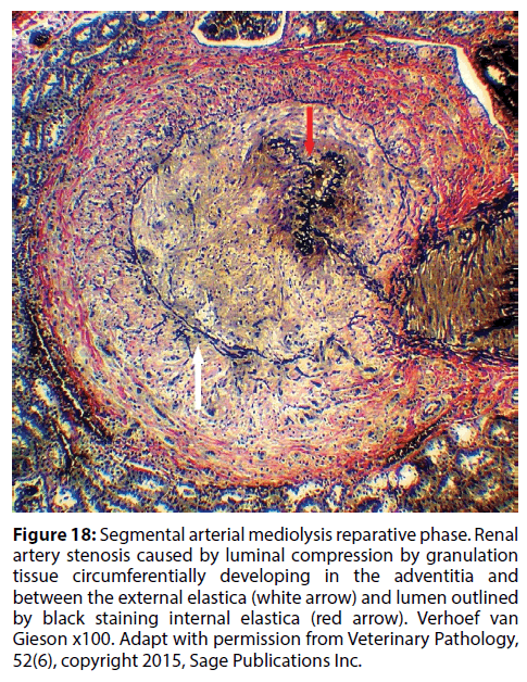 interventional-cardiology-compression-granulation