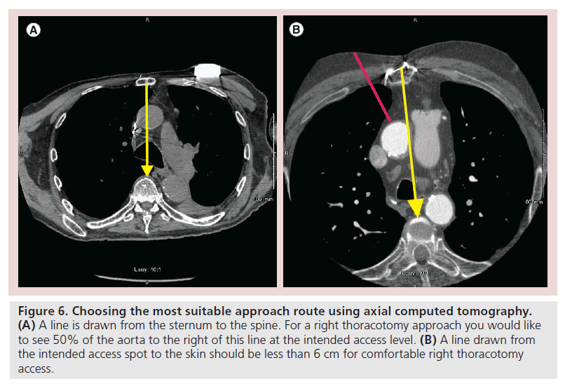 interventional-cardiology-computed-tomography