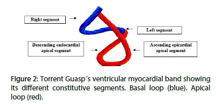 interventional-cardiology-constitutive-segments