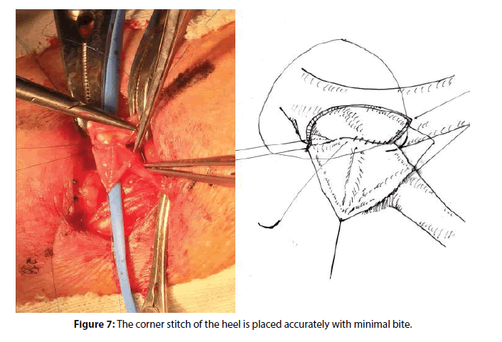 interventional-cardiology-corner-stitch