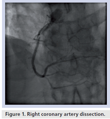 interventional-cardiology-coronary