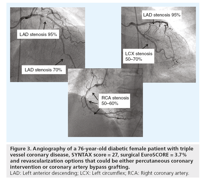 interventional-cardiology-coronary-disease