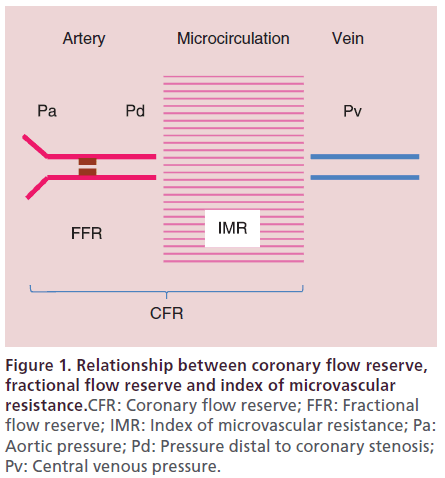 interventional-cardiology-coronary-flow-reserve