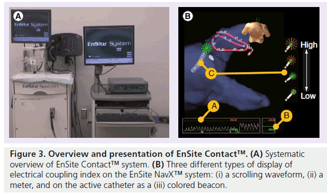 interventional-cardiology-coupling