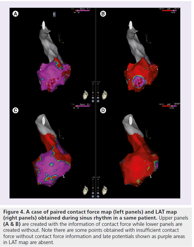 interventional-cardiology-coupling