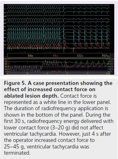 interventional-cardiology-coupling