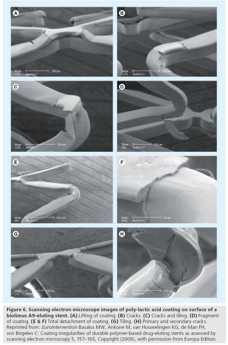 interventional-cardiology-detachment-coating