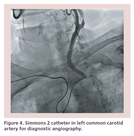 interventional-cardiology-diagnostic-angiography