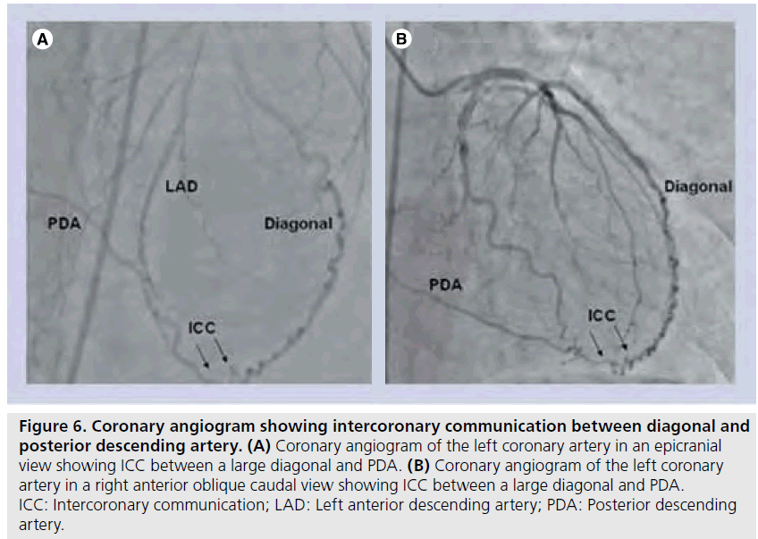 interventional-cardiology-diagonal