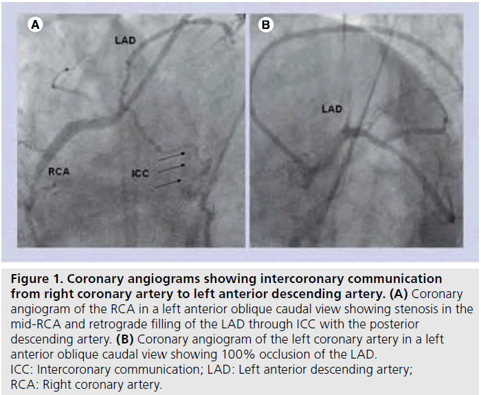 interventional-cardiology-diameter