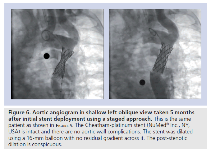 interventional-cardiology-dilation-conspicuous