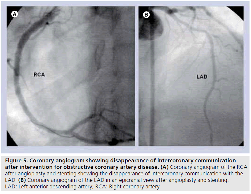 interventional-cardiology-disease