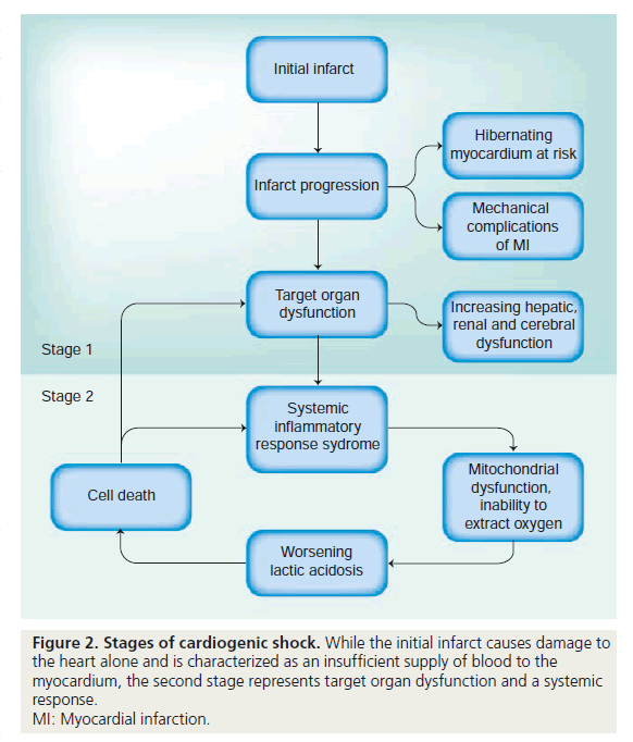 interventional-cardiology-dysfunction-systemic