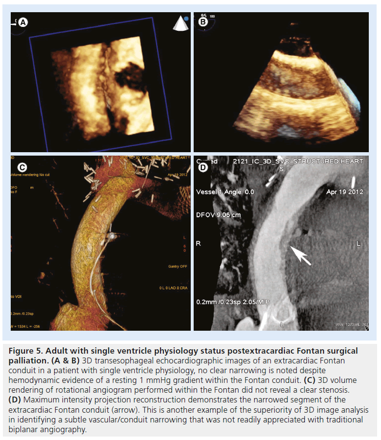 interventional-cardiology-echocardiographic-images