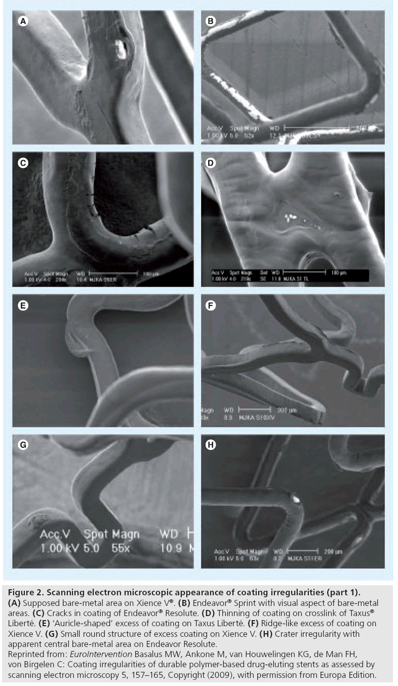 interventional-cardiology-electron-microscopic