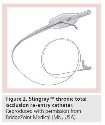 interventional-cardiology-entry-catheter