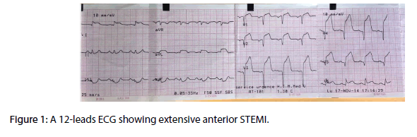 interventional-cardiology-extensive-anterior