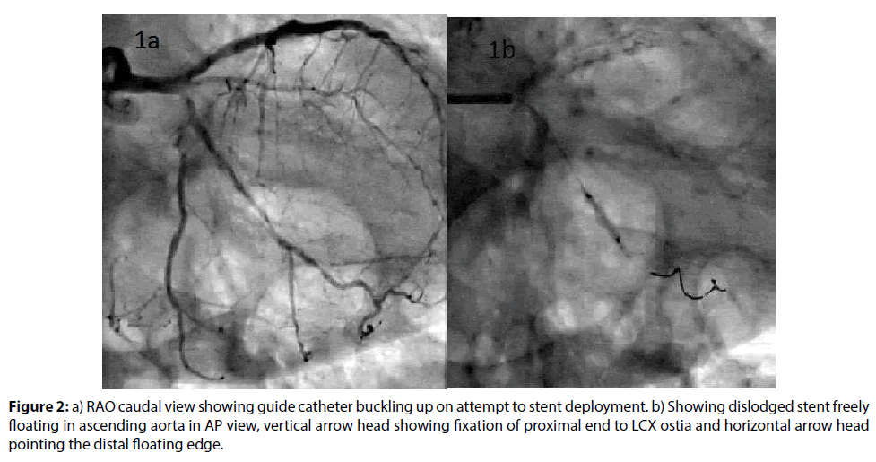 interventional-cardiology-floating-edge