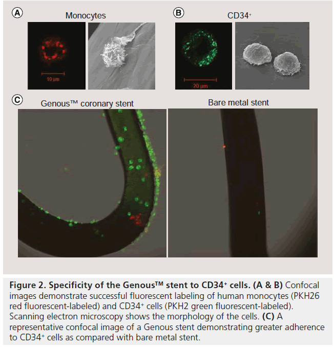 interventional-cardiology-fluorescent-human