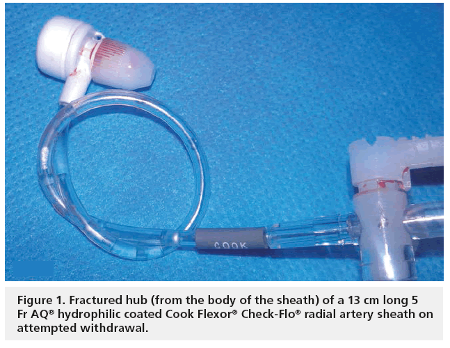 interventional-cardiology-fractured-hub