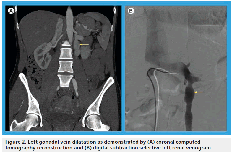 interventional-cardiology-gonadal