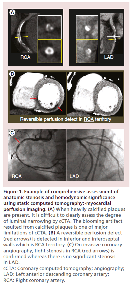 interventional-cardiology-hemodynamic