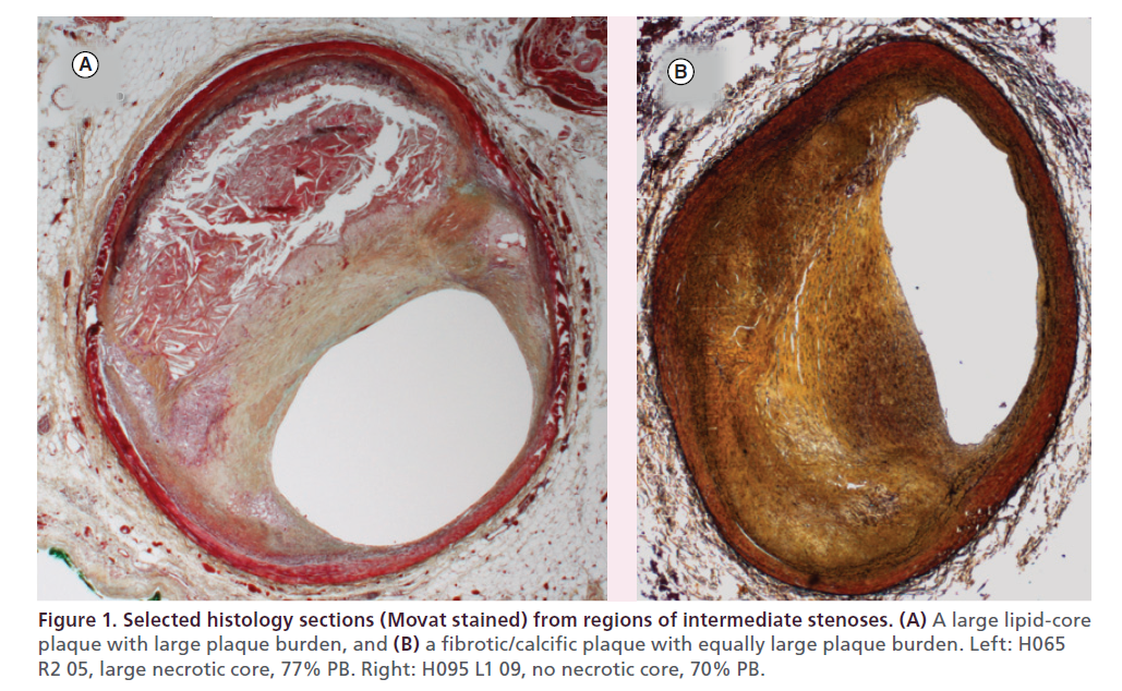 interventional-cardiology-histology-sections