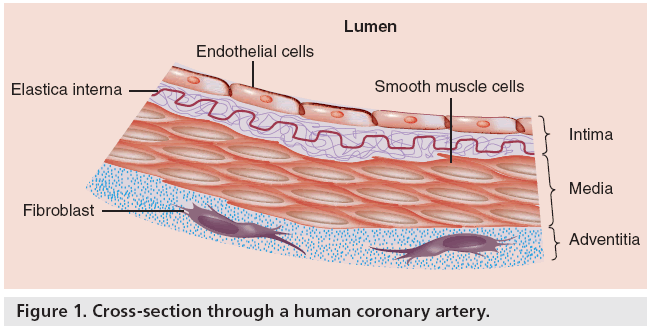 interventional-cardiology-human-coronary-artery