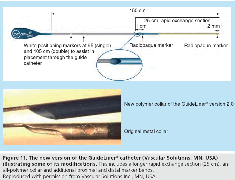 interventional-cardiology-illustrating-some-modifications