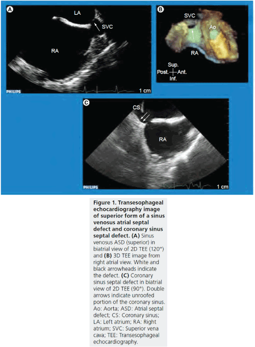 interventional-cardiology-image