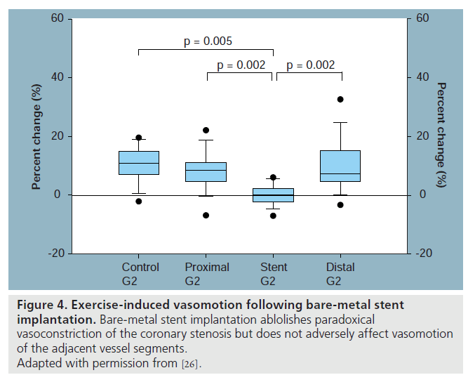 interventional-cardiology-induced-vasomotion