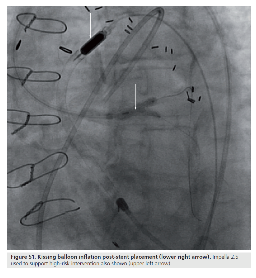 interventional-cardiology-inflation