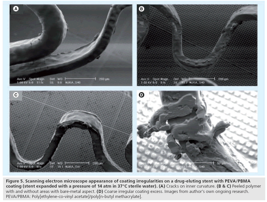 interventional-cardiology-inner-curvature