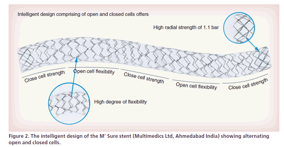 interventional-cardiology-intelligent-design