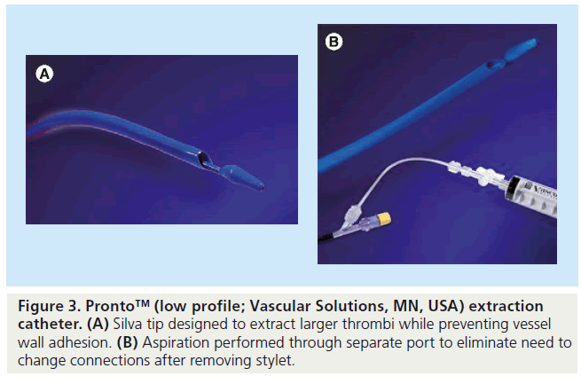 interventional-cardiology-larger-stylet