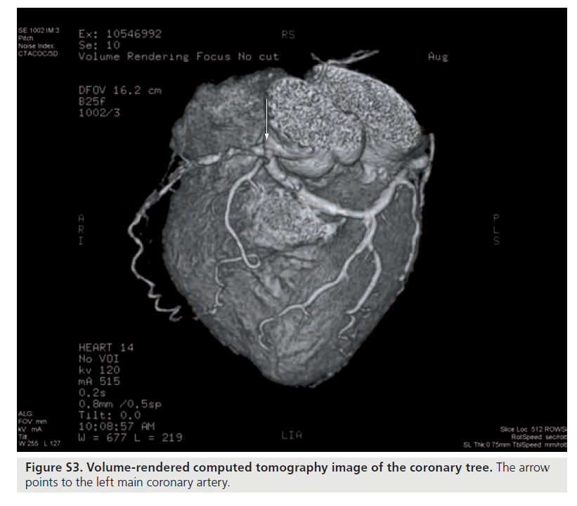 interventional-cardiology-left-main