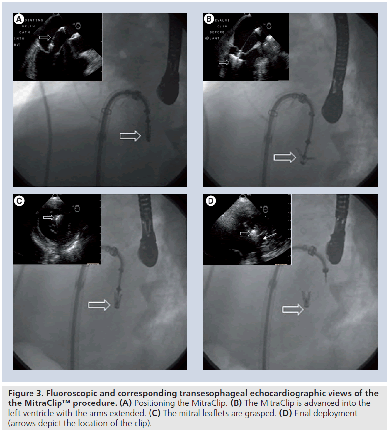interventional-cardiology-location