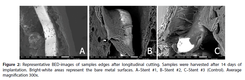 interventional-cardiology-longitudinal-cutting