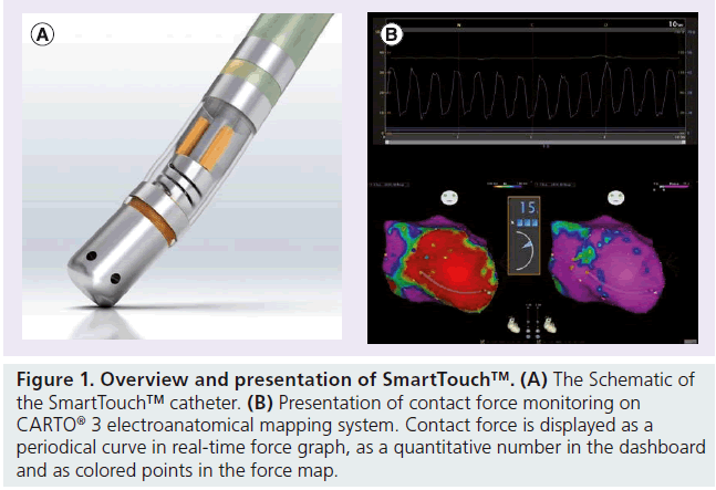 interventional-cardiology-manual