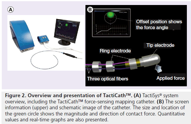 interventional-cardiology-mapping