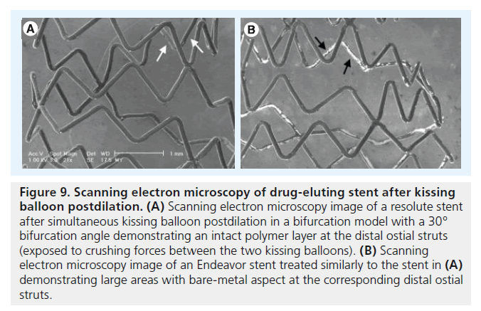 interventional-cardiology-metal-aspect