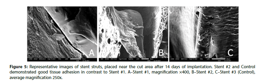 interventional-cardiology-metal-surfaces