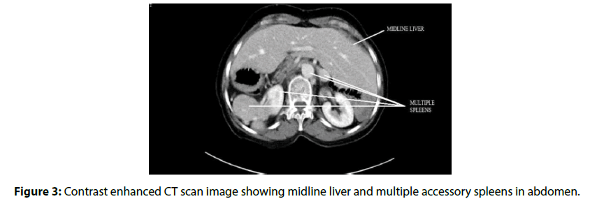 neuropsychiatryinterventional-cardiology-midline-liver