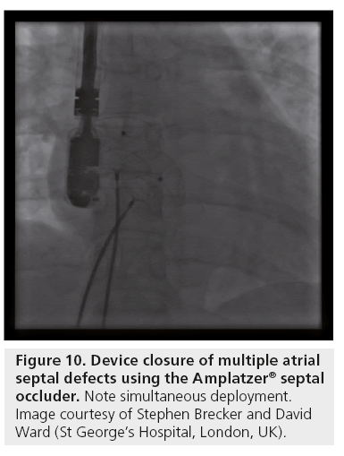interventional-cardiology-multiple-atrial