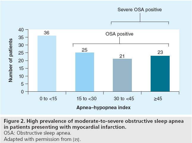 interventional-cardiology-myocardial-infarction