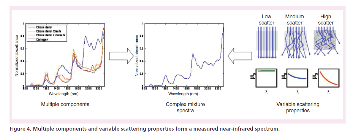 interventional-cardiology-near-infrared-spectrum