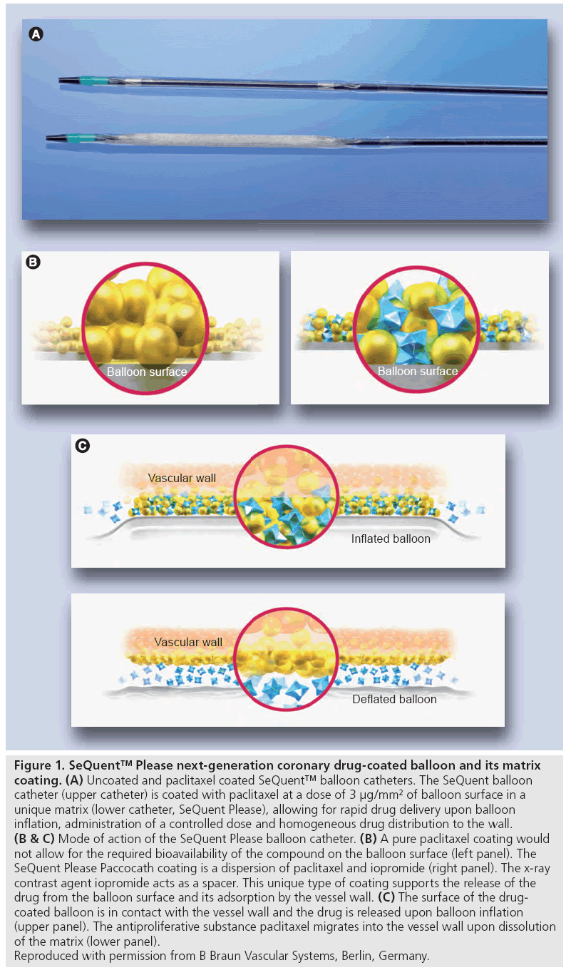 interventional-cardiology-next-generation-coronary