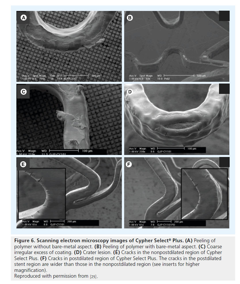interventional-cardiology-nonpostdilated-region