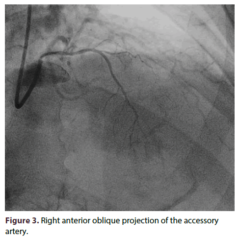 interventional-cardiology-oblique-projection